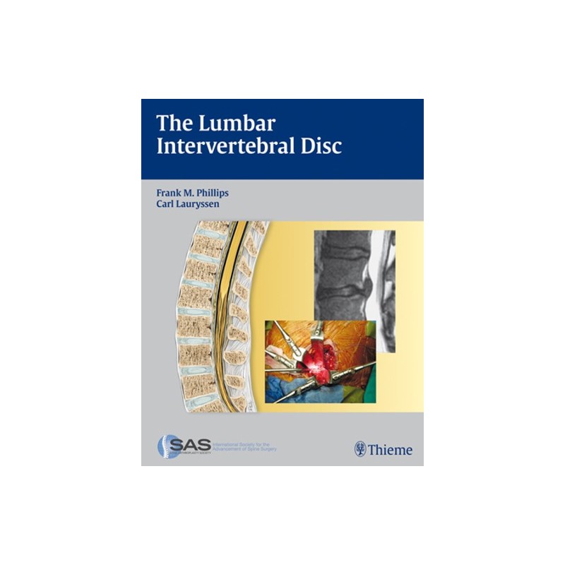 The Lumbar Intervertebral Disc